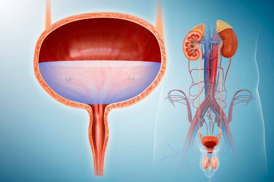 Irritable bowel syndrome and bladder problems