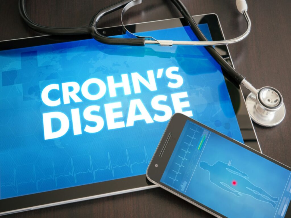 Crohn's Disease Life Expectancy The IBS & Gut Health Clinic