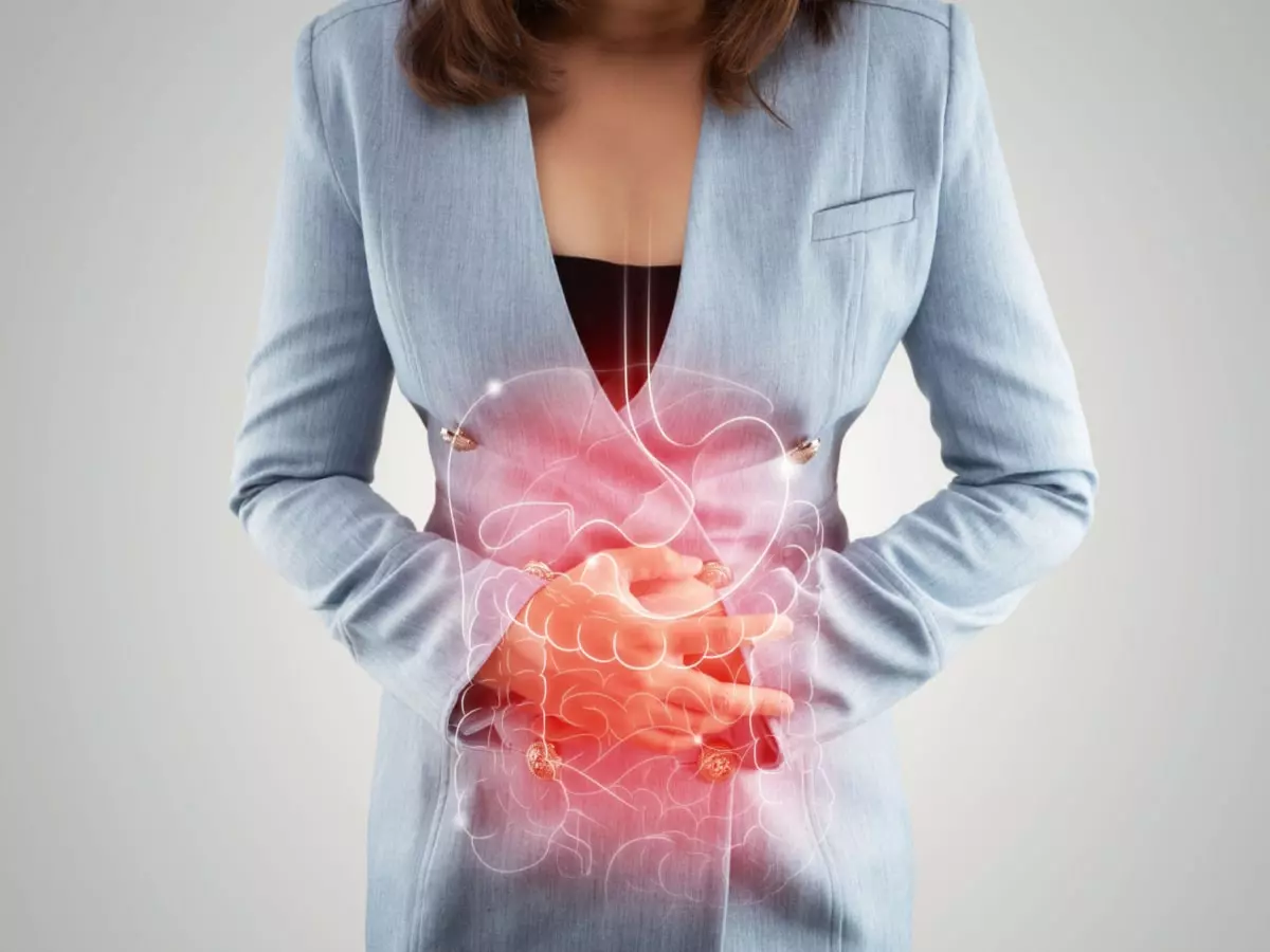 Ulcerative Colitis
