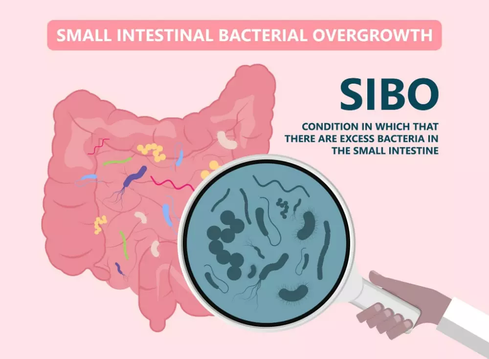 Sibo