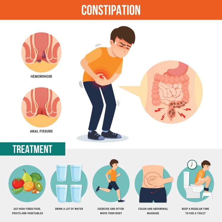 Where Is Constipation Pain Felt The IBS Gut Health Clinic
