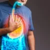 Acid Reflux