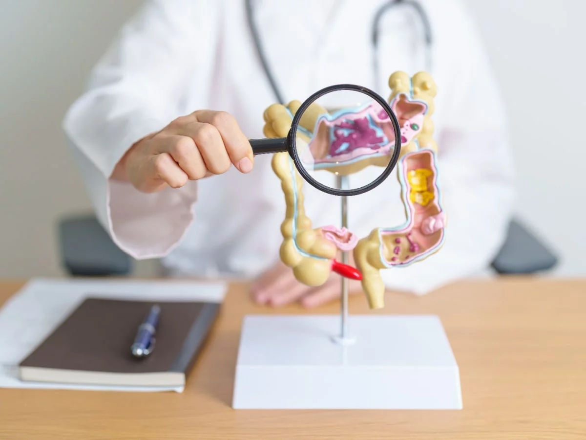 Symptoms of Diverticulitis