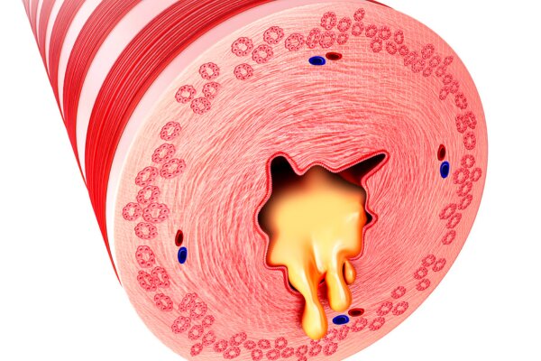 Mucus in Stool: What It Means and When to Seek Advice | The IBS & Gut